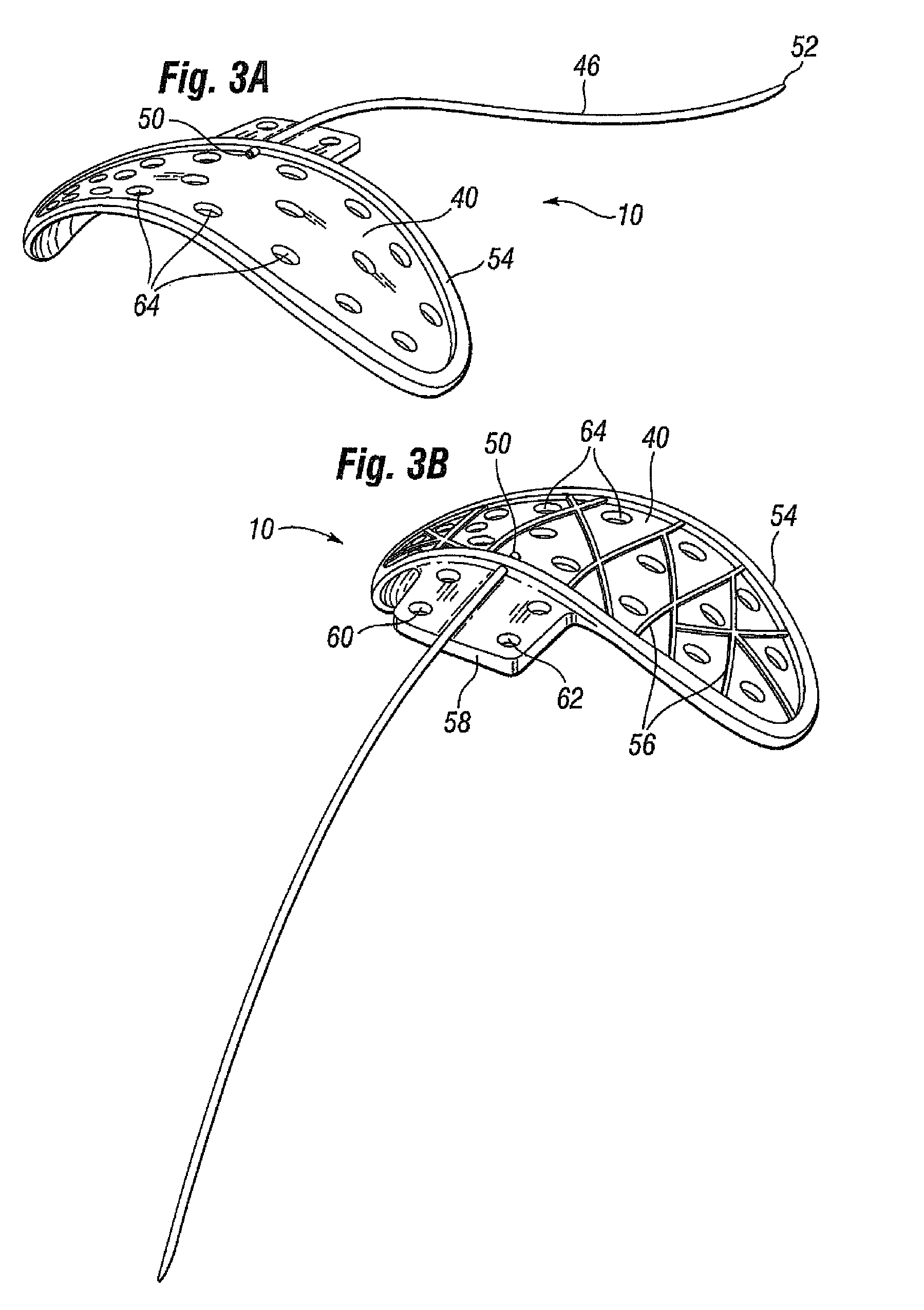 Glaucoma drainage shunts and methods of use