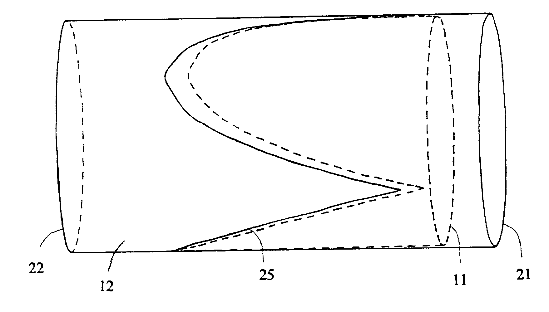 Venous valve and graft combination