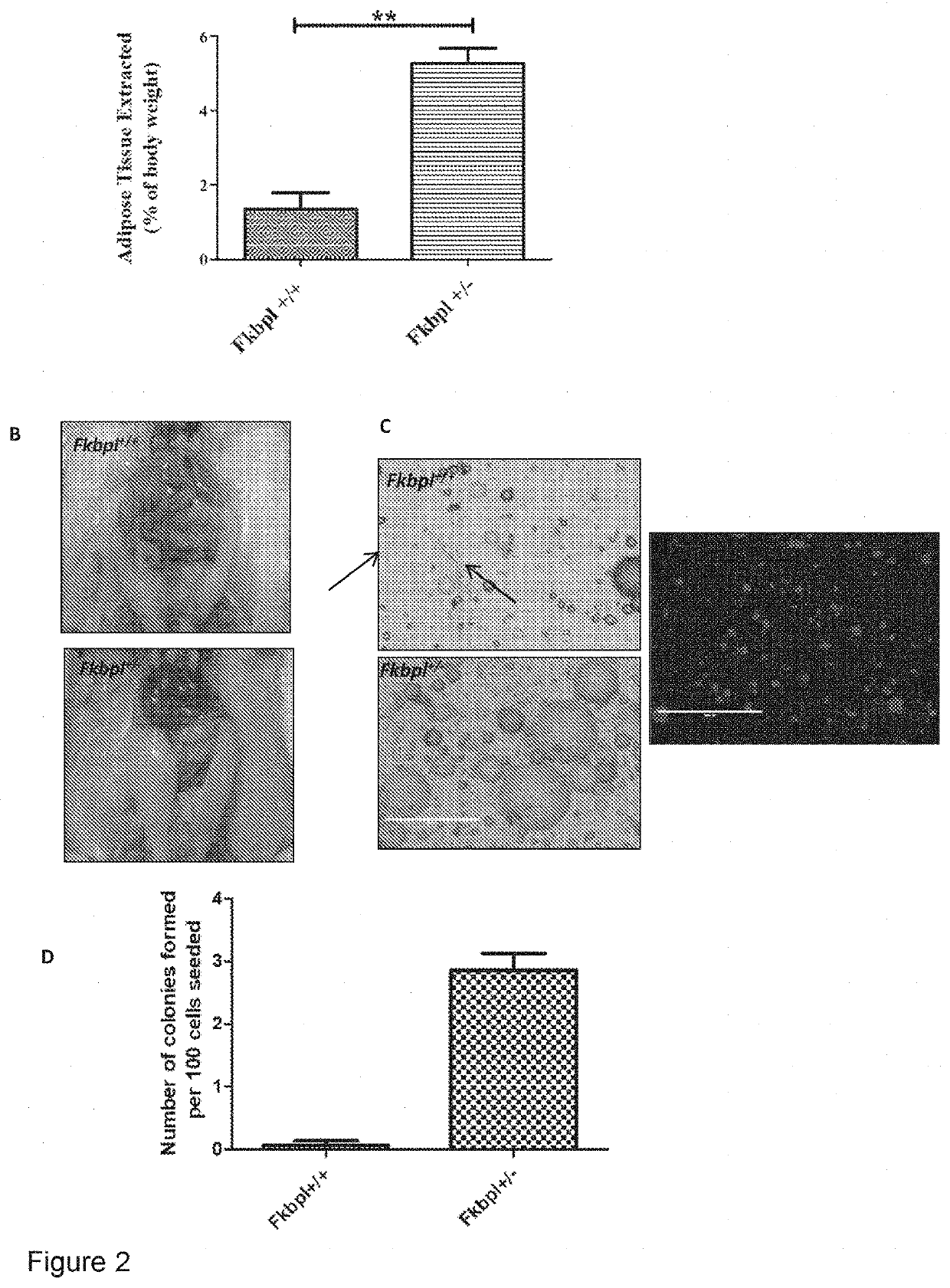 Use of FKBP-L polypeptides and nucleic acids for the treatment of obesity