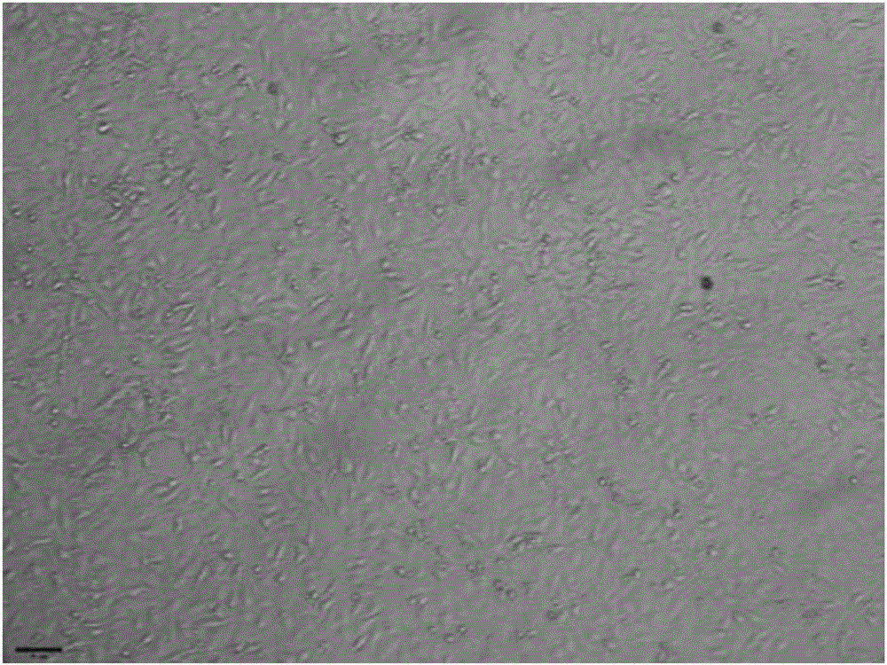 Porcine ovarian granulosa cell primary culture method