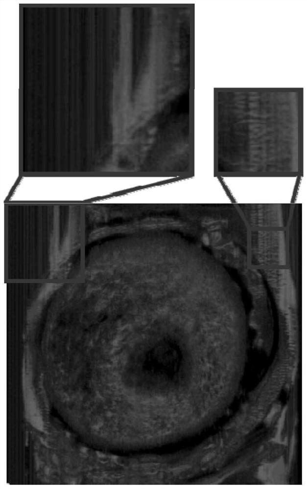 Method for removing noise in ultrasonic image, ultrasonic equipment and storage medium