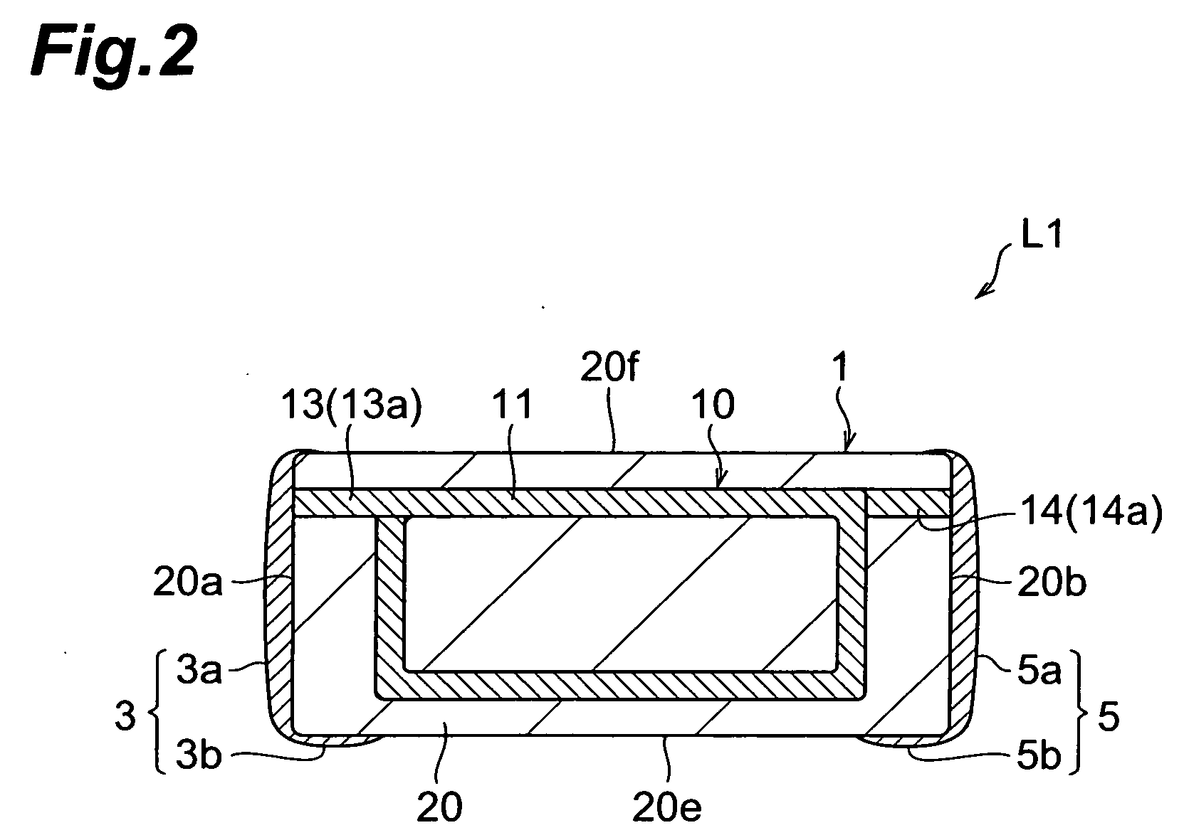 Coil component