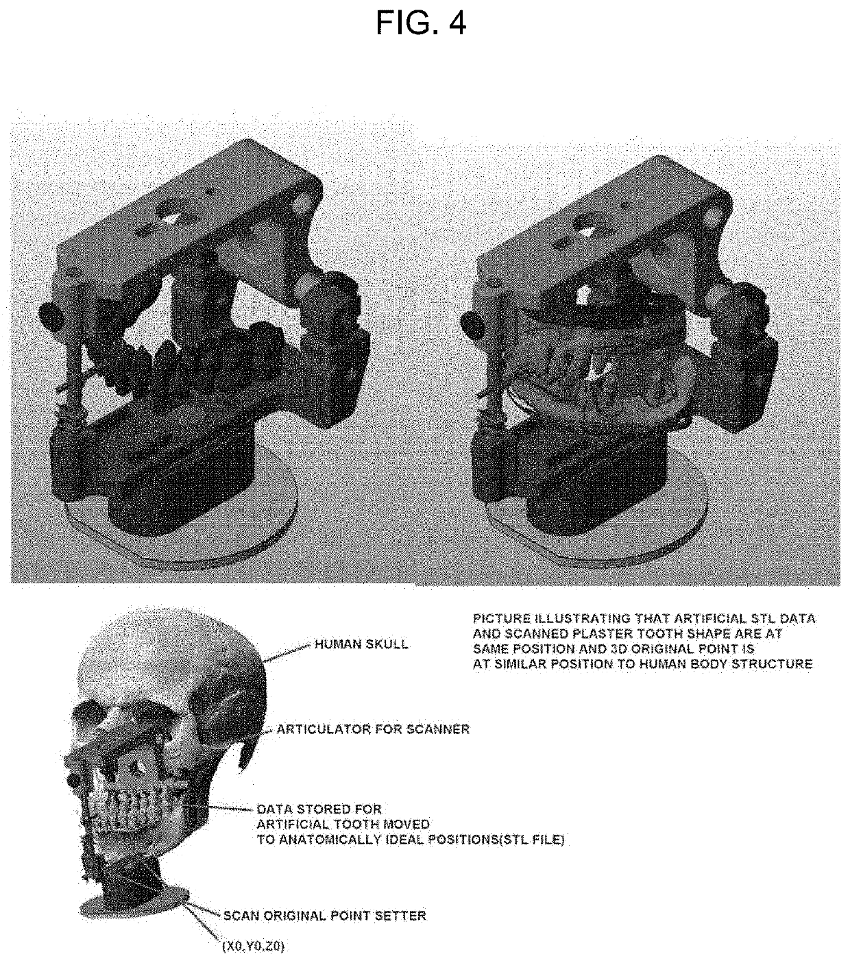 Digital three-dimensional tooth model system