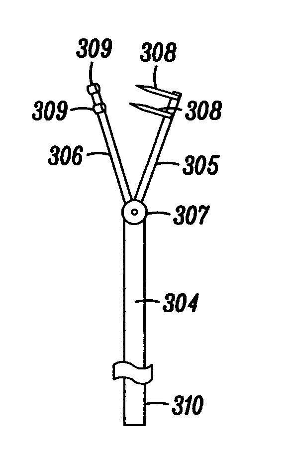 Devices, systems and methods for tissue repair