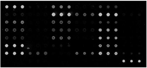 Hereditary deafness related gene detection chip kit