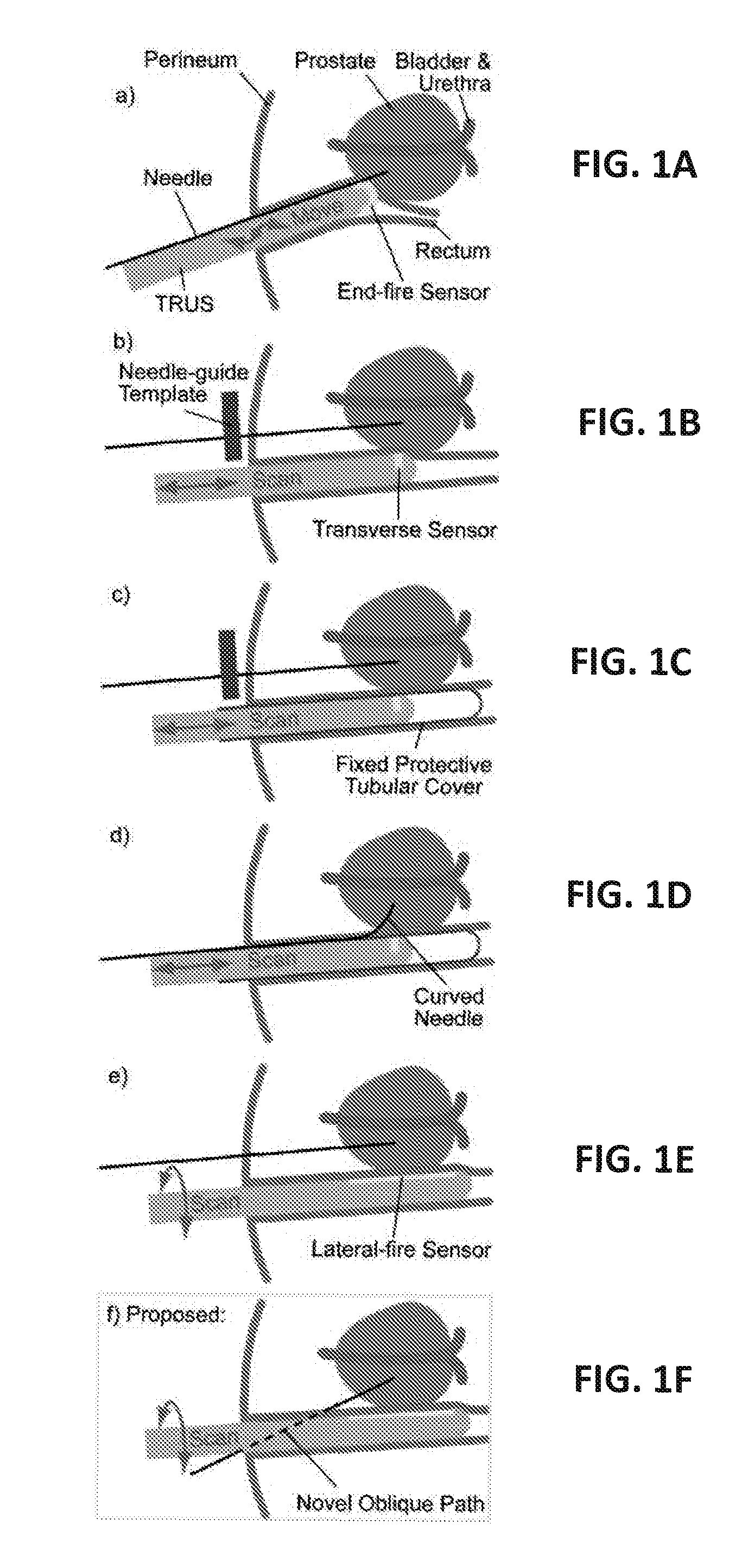 Cohesive robot-ultrasound probe for prostate biopsy