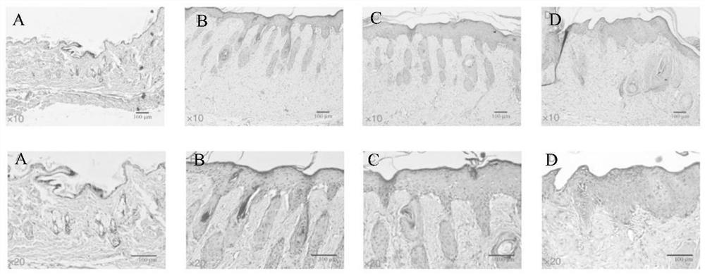 Application of tRFs in product for treating acute skin injury caused by UV radiation