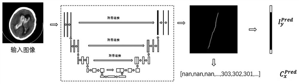 Automatic positioning method and device of brain midline