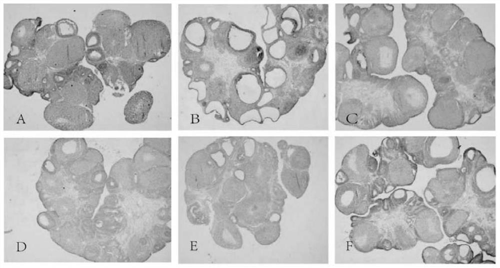 A traditional Chinese medicine composition for invigorating kidney and removing turbidity and its application