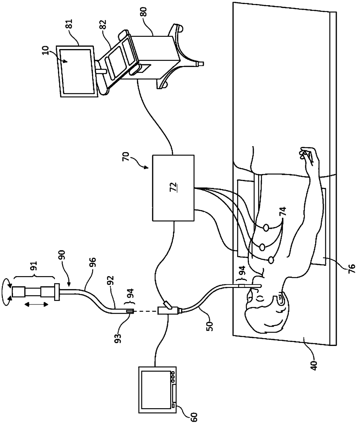 System and method for navigational bronchoscopy and selective drug delivery