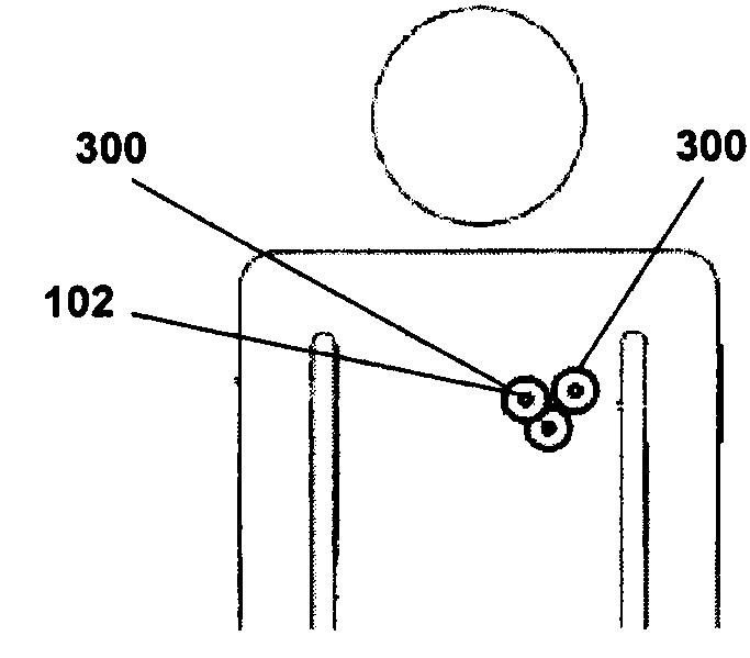 Systems and methods for detecting cardiovascular disease