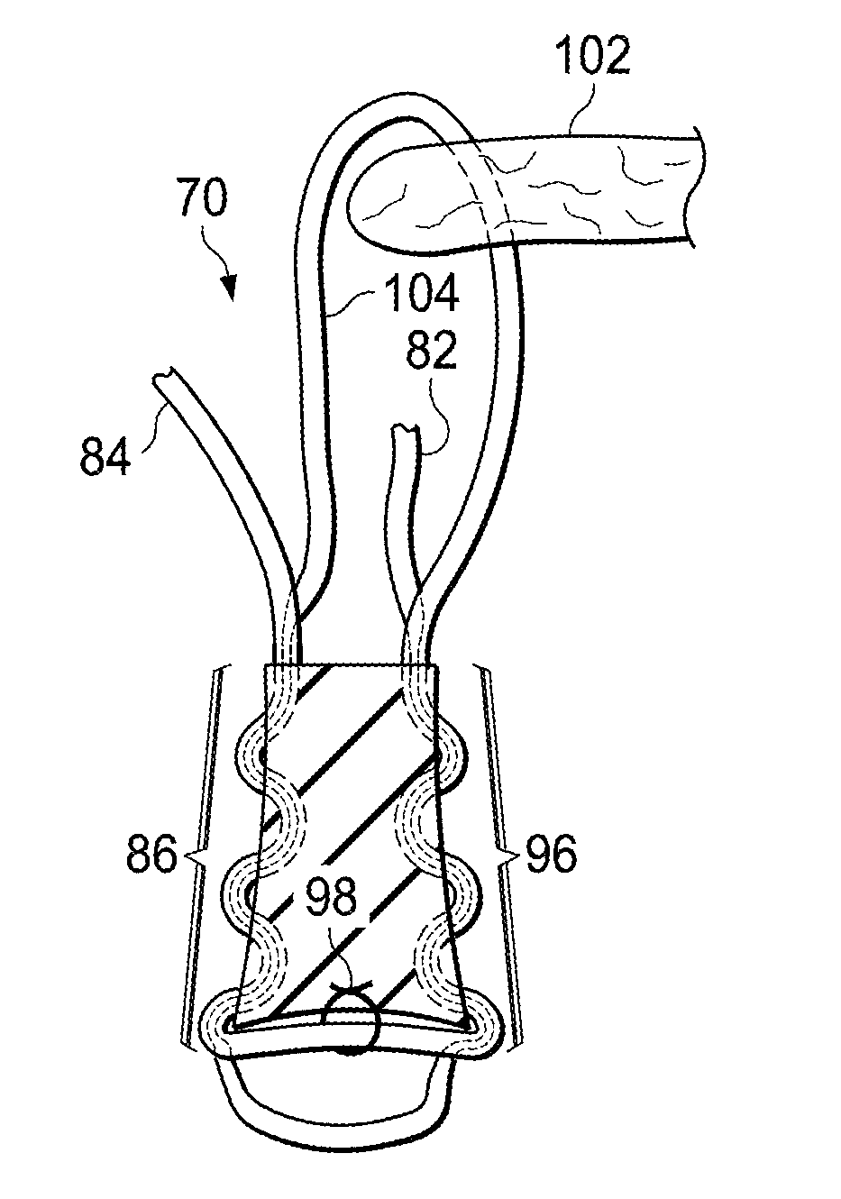 Knotless all suture tissue repair