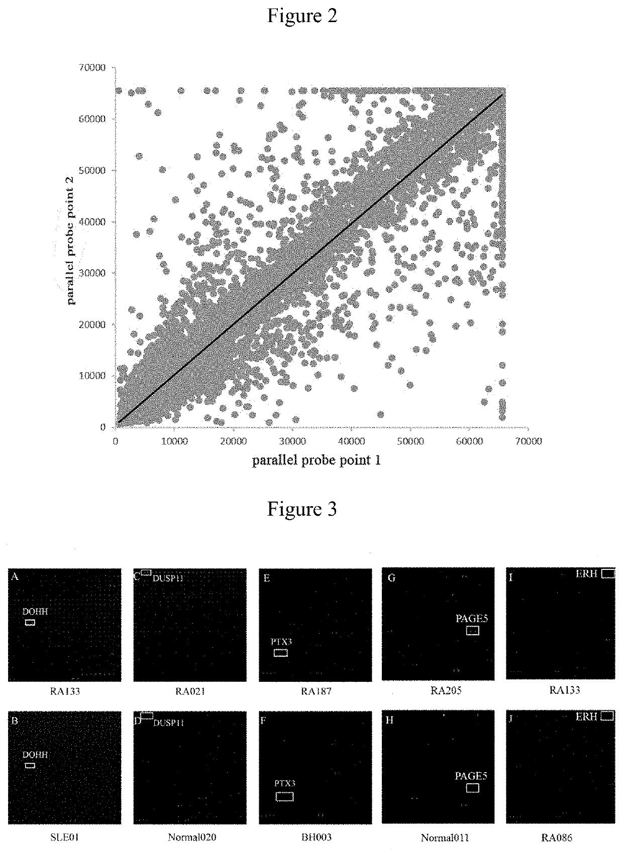 Acpa-negative ra diagnostic marker and application thereof