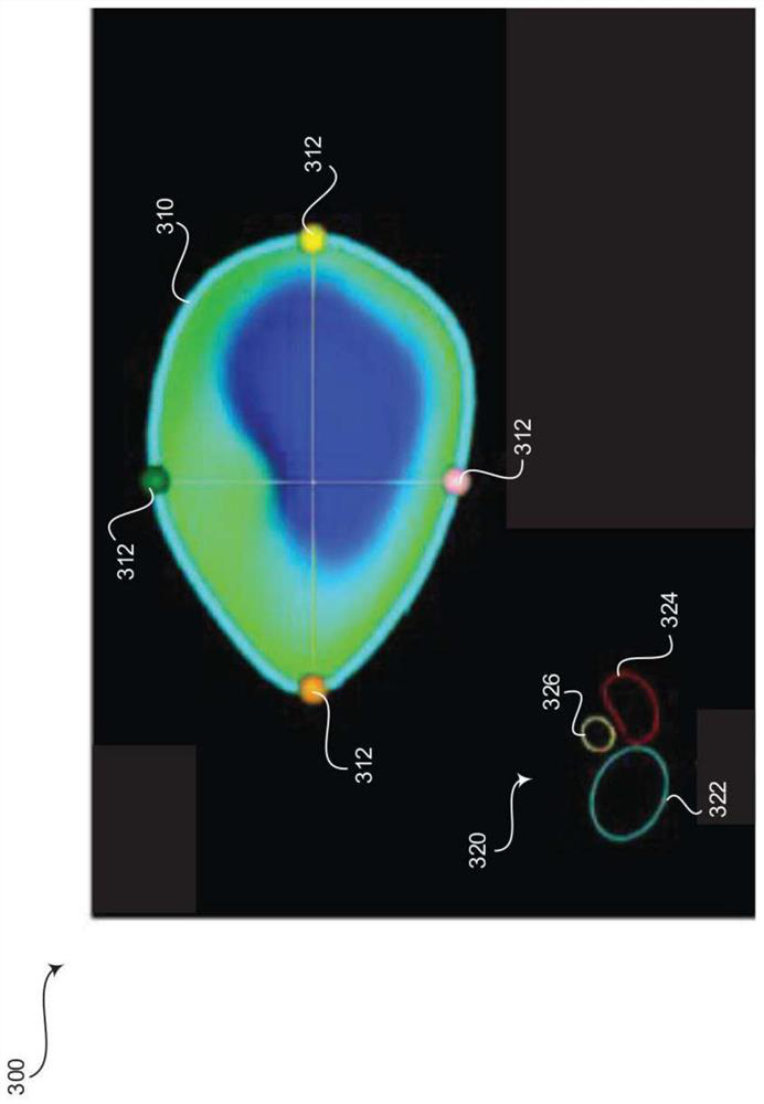 Methods and systems for providing anatomical orientation indicators