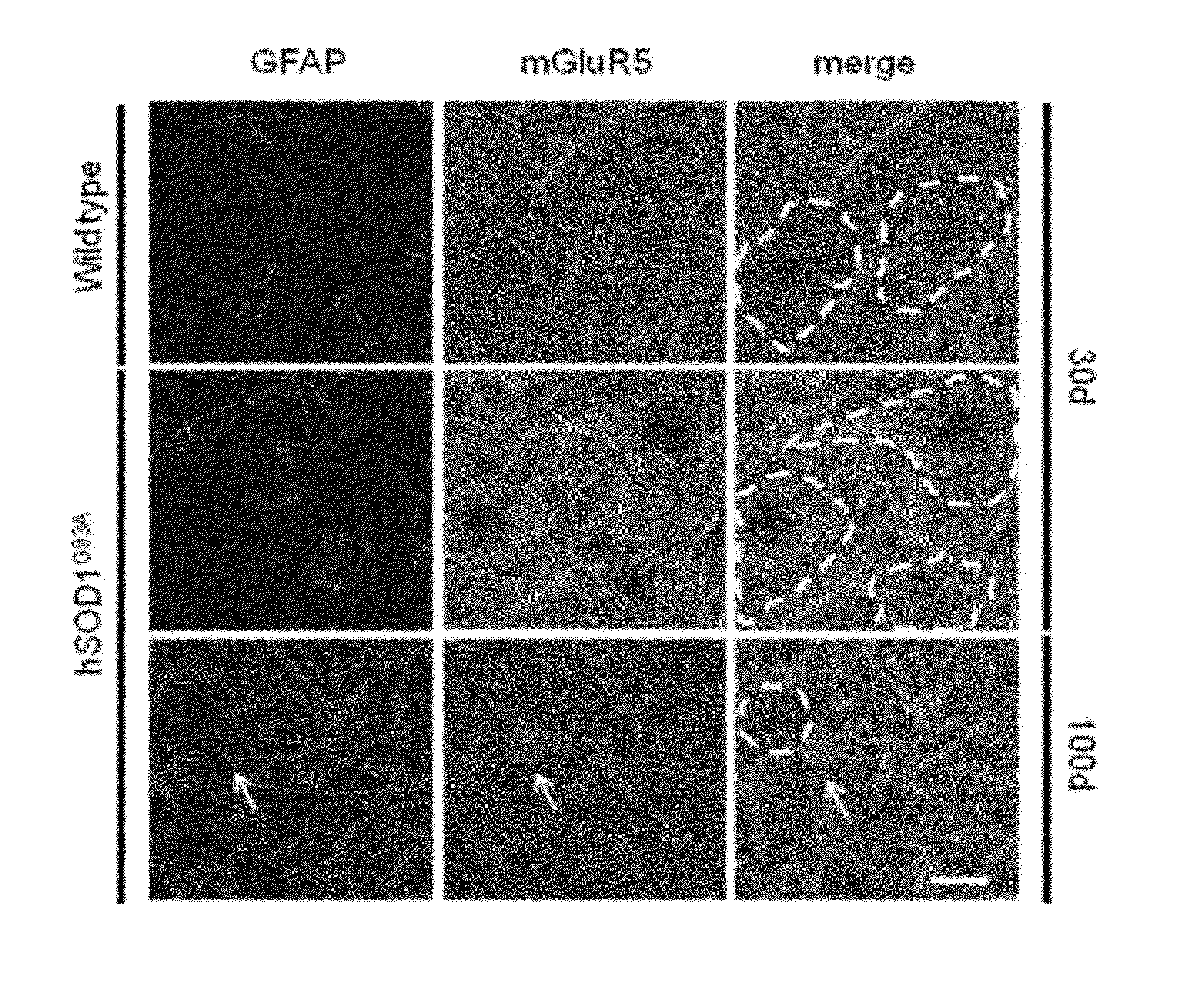 Glioprotectant Peptide for Use in the Treatment of Amyotrophic Lateral Sclerosis (ALS) and Methods Related Thereto