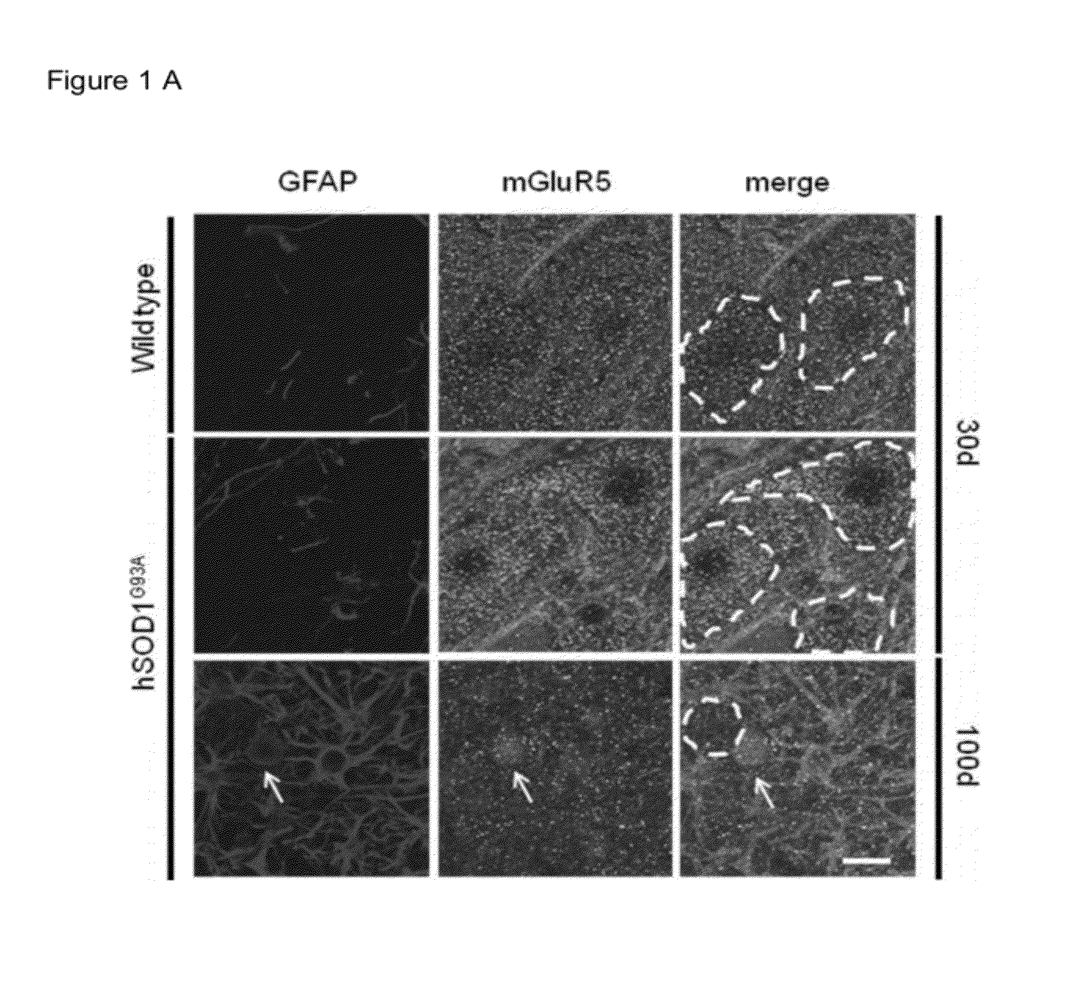 Glioprotectant Peptide for Use in the Treatment of Amyotrophic Lateral Sclerosis (ALS) and Methods Related Thereto