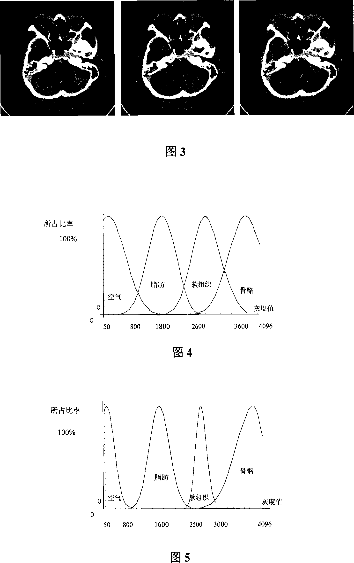 Self-adapting medicine sequence image values inserting method based on interested region