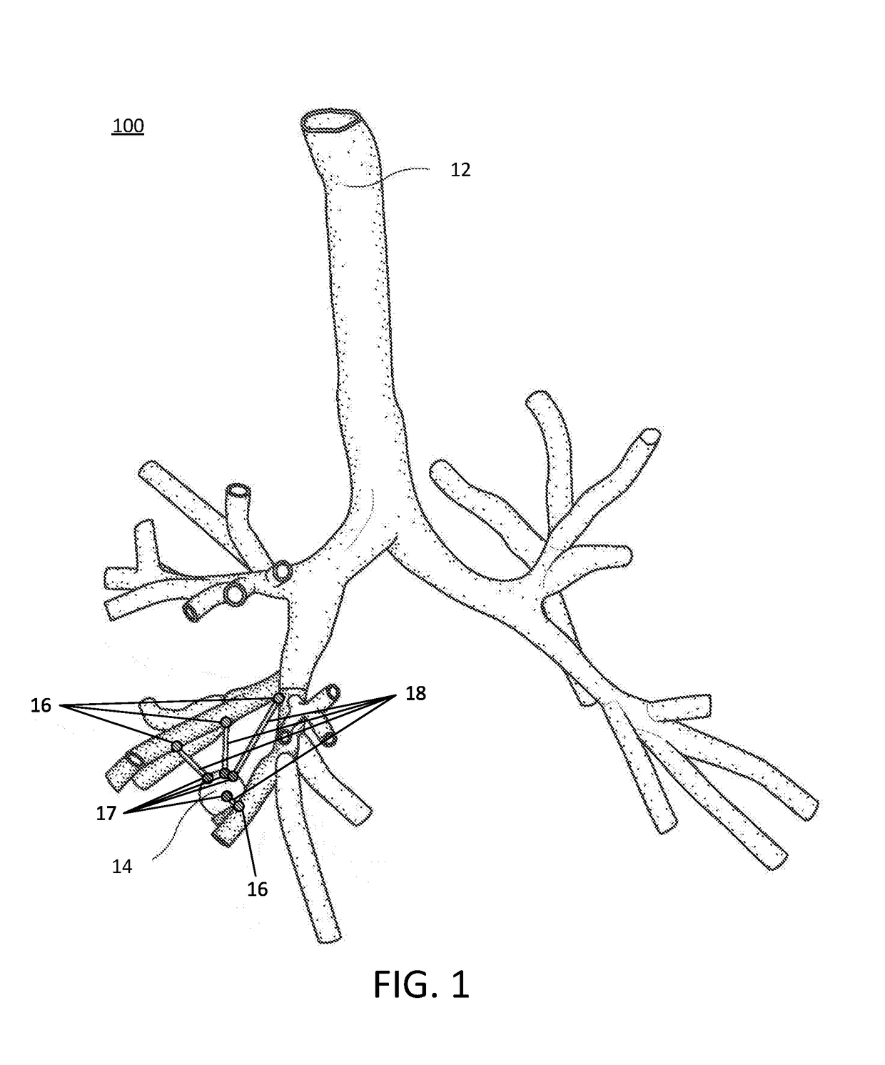 Pathway planning for use with a navigation planning and procedure system