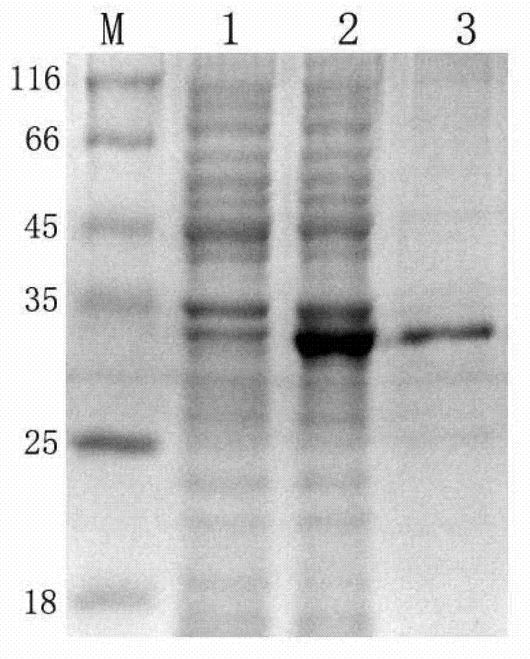 Preparation and application of tumor marker calreticulin detection kit