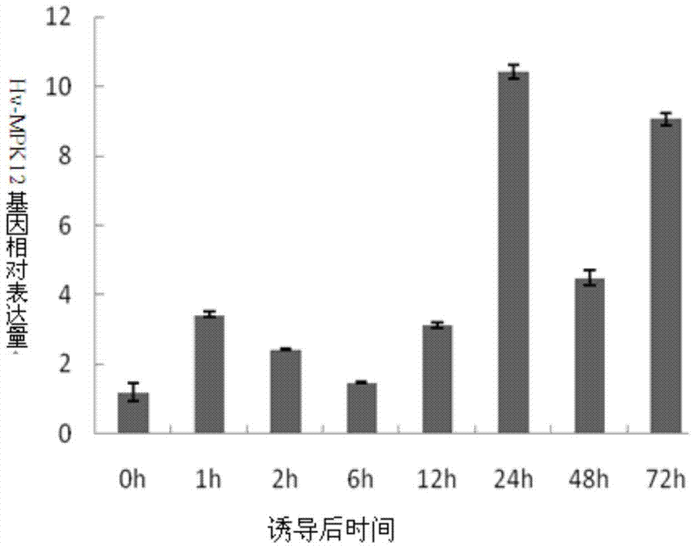 Haynaldia villosa mitogen activated protein kinase gene, and expression vector and application thereof