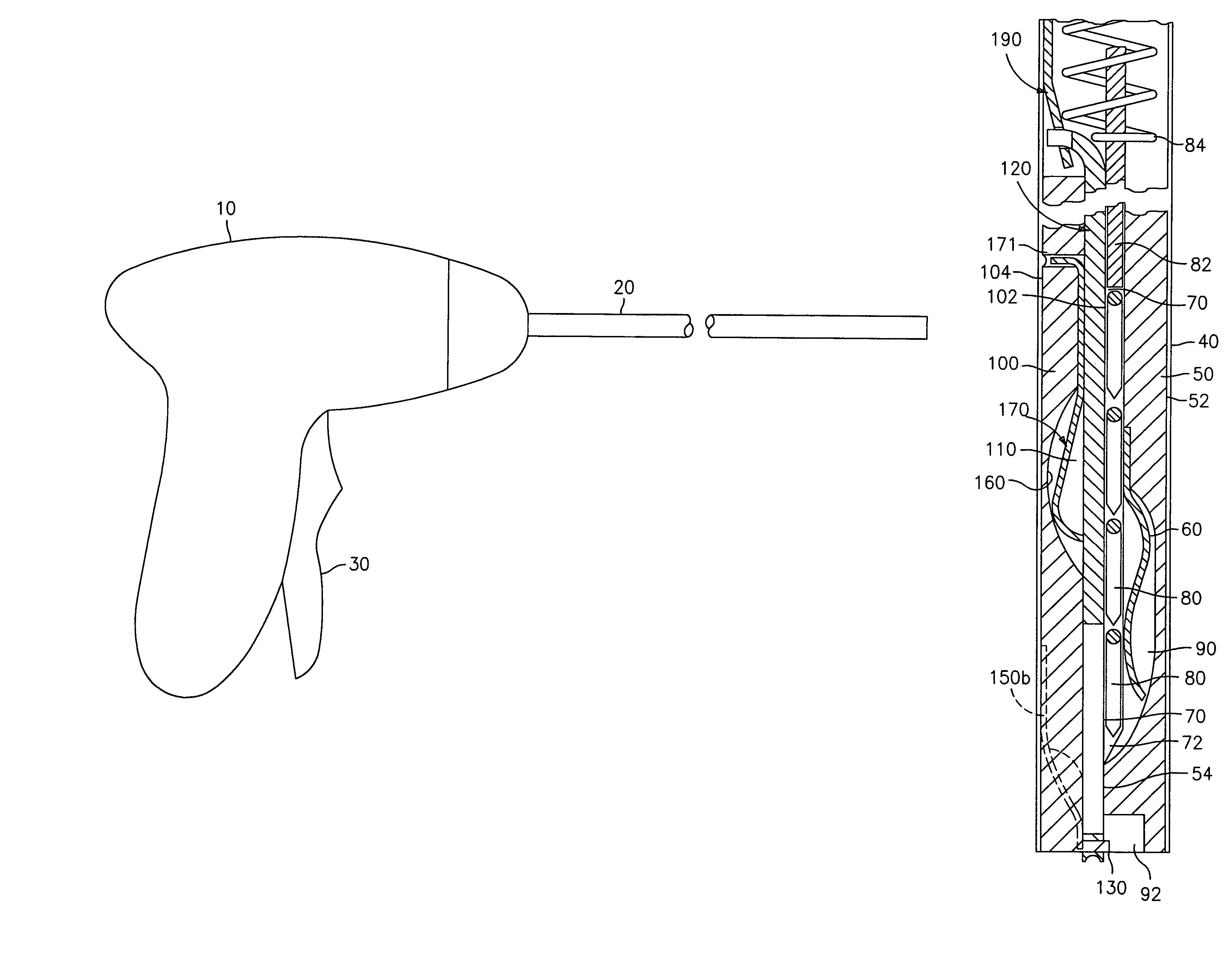 Apparatus and method for surgical fastening