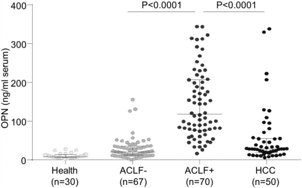 Application of osteopontin in preparation or screening of diagnostic reagents for acute-on-chronic liver failure