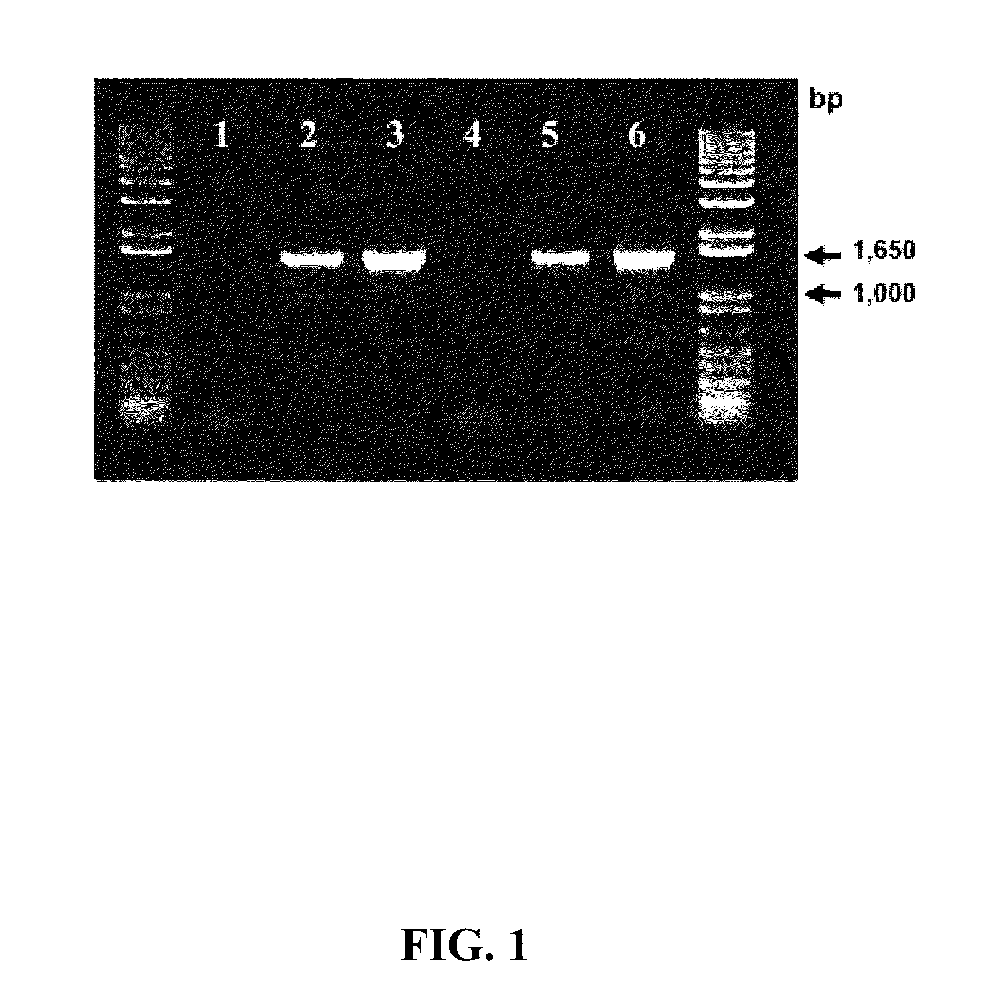 1, 2-Dichloropropane-to-Propene Reductive Dehalogenase Genes