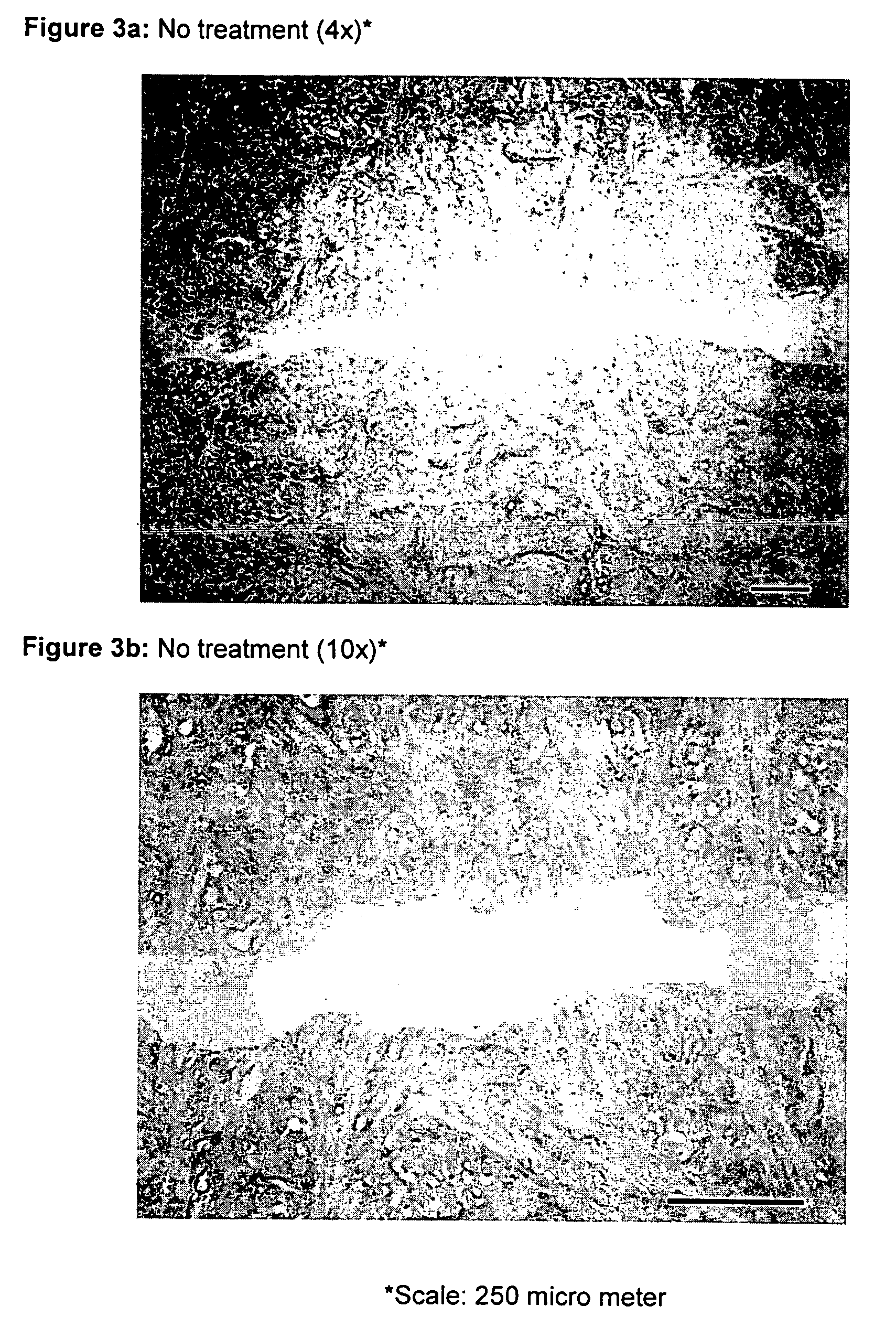 Method for treatment and repair of meniscal injuries