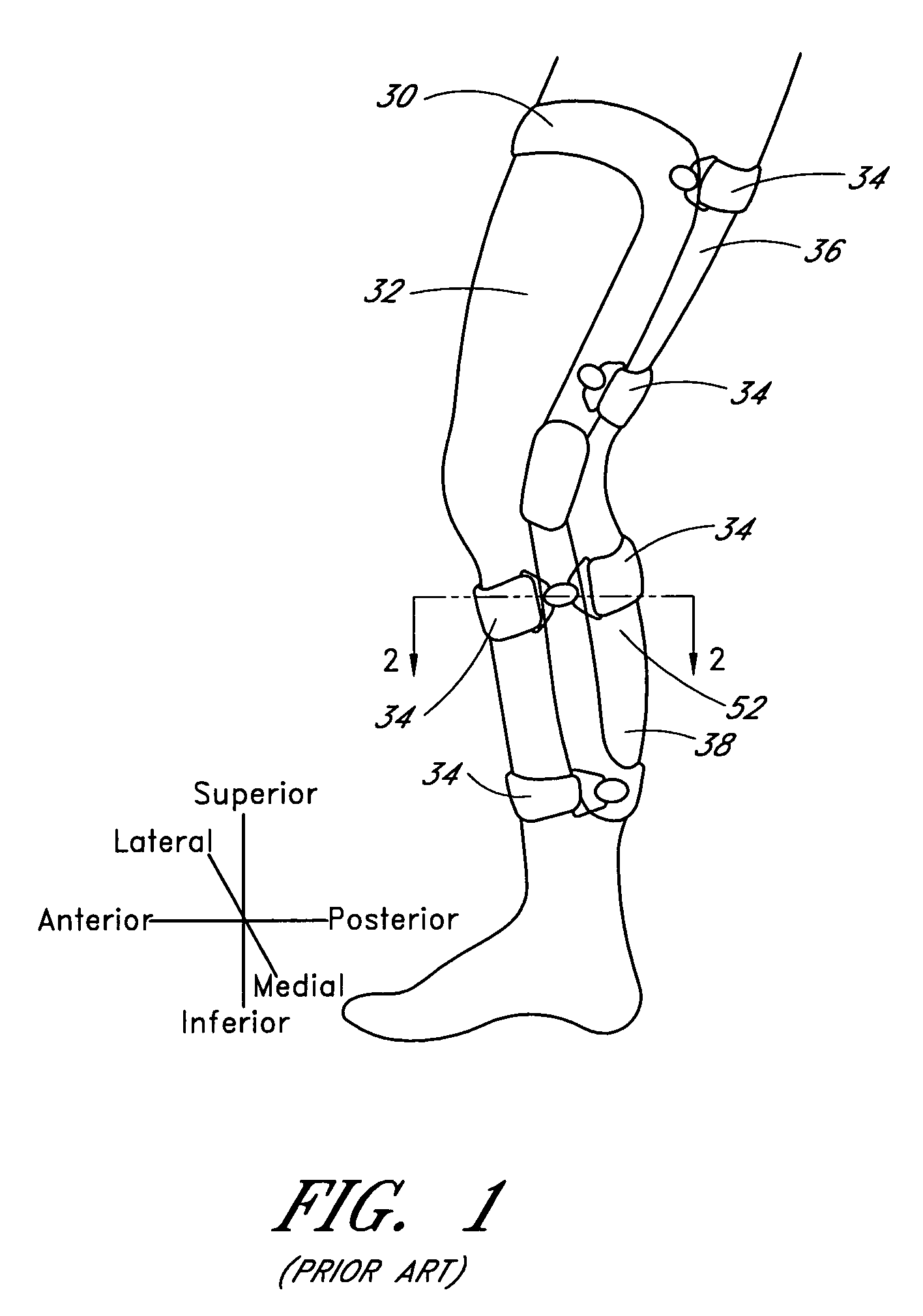 Orthopedic brace suspension system