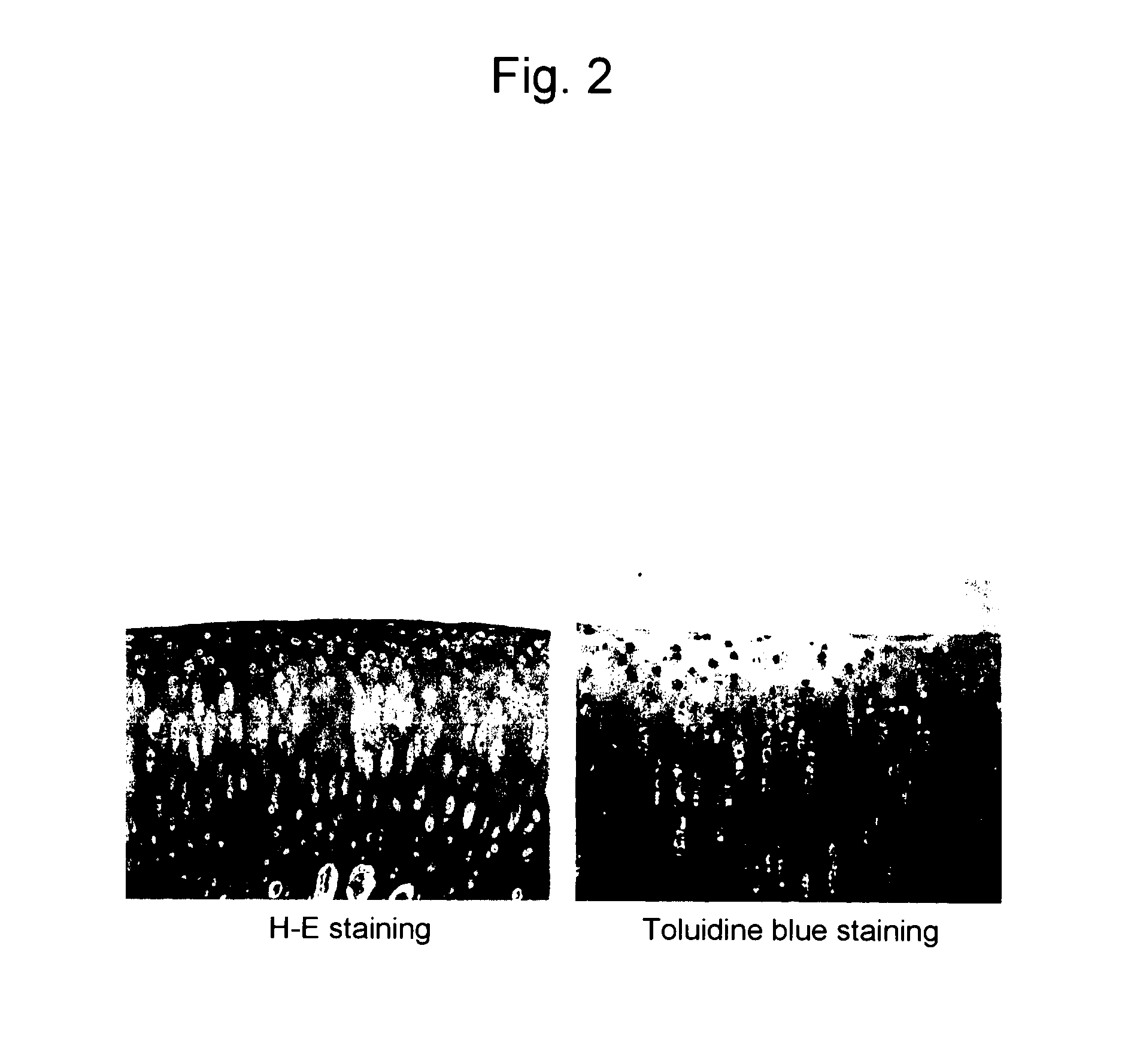 Combined preparation for treating joint diseases