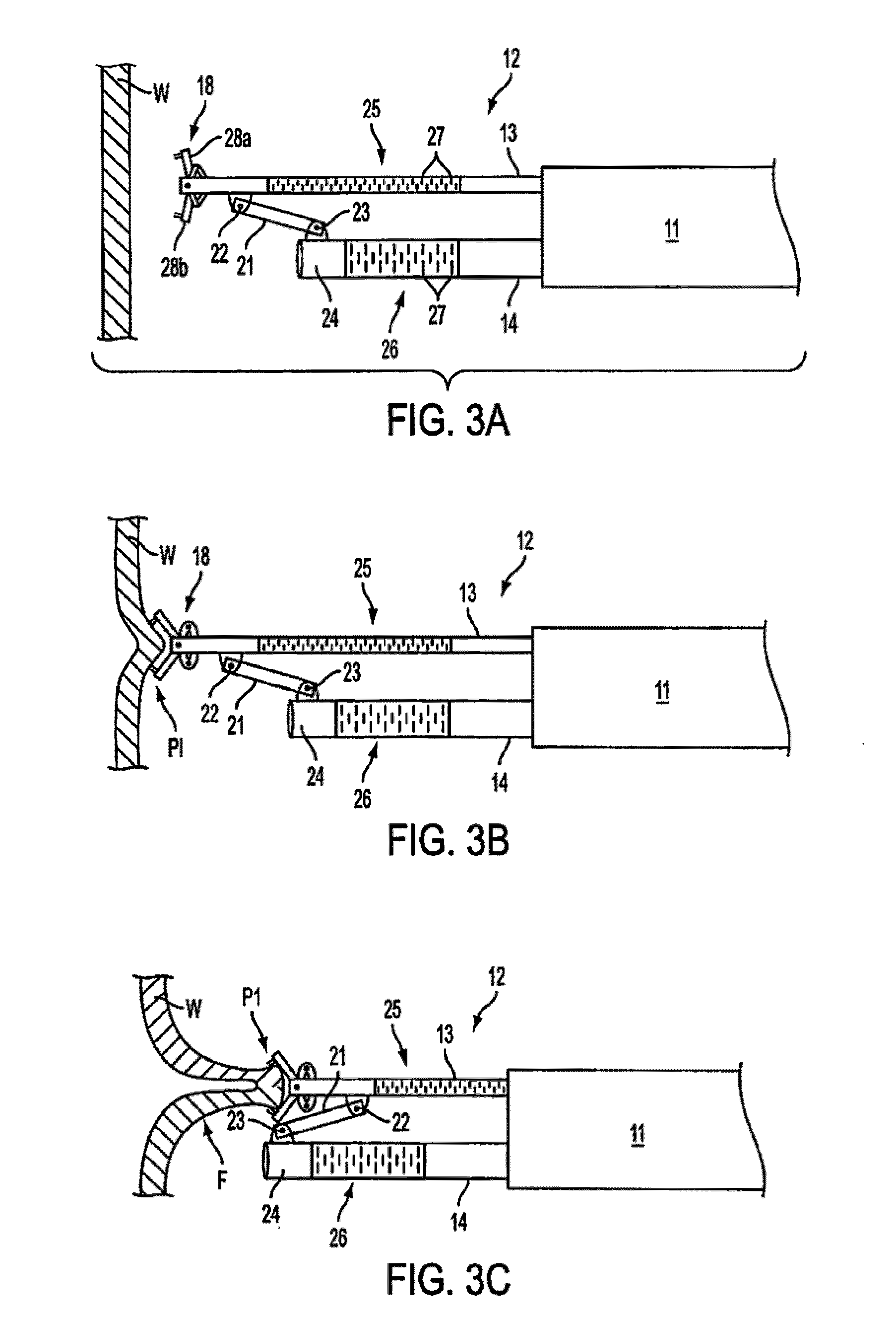 Apparatus and methods for forming gastrointestinal tissue approximations