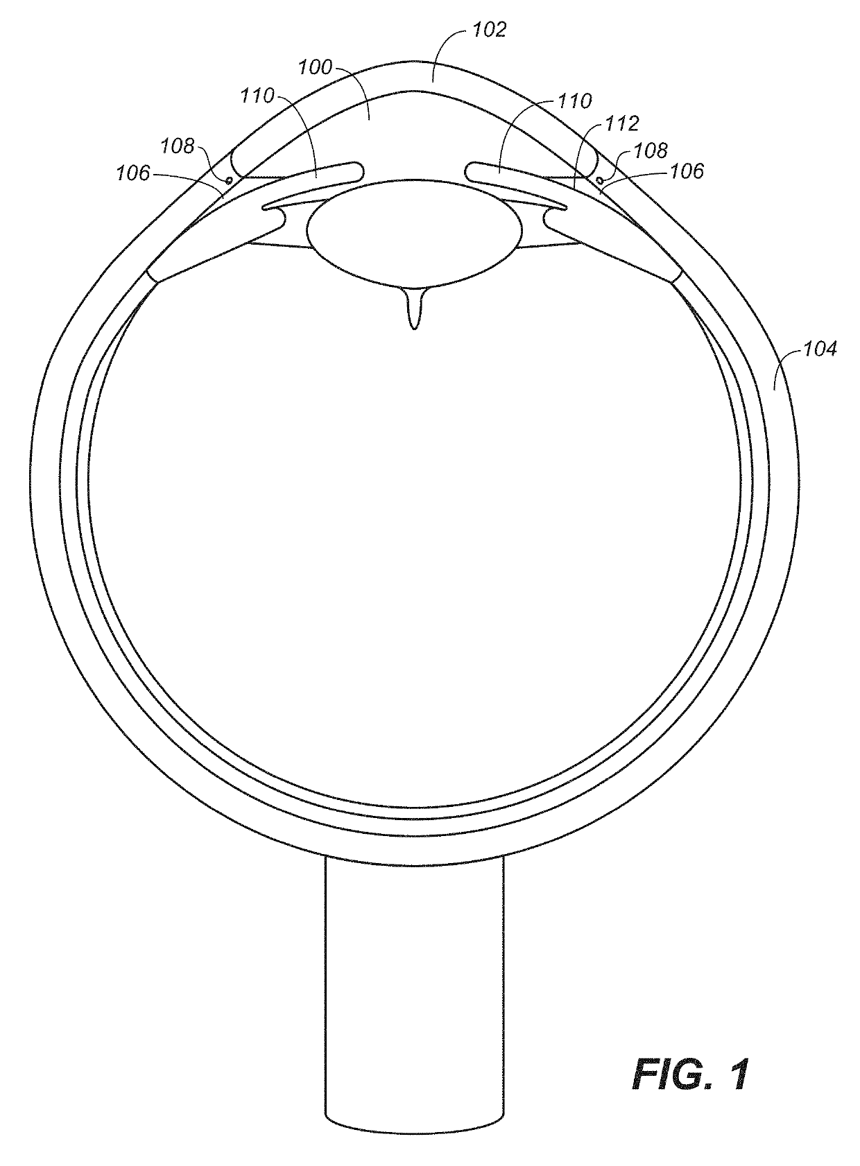 Ocular delivery systems and methods