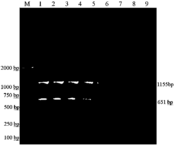 Duplex PCR (polymerase chain reaction) detection primer and kit for quickly distinguishing porcine circoviruses type 2 and type 3