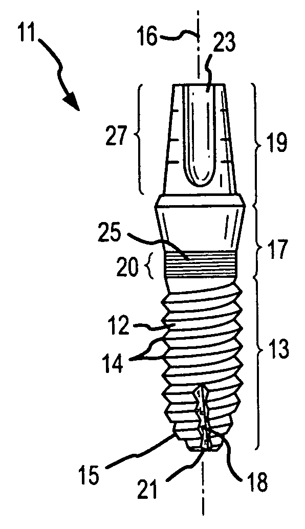 Screw-type dental implant