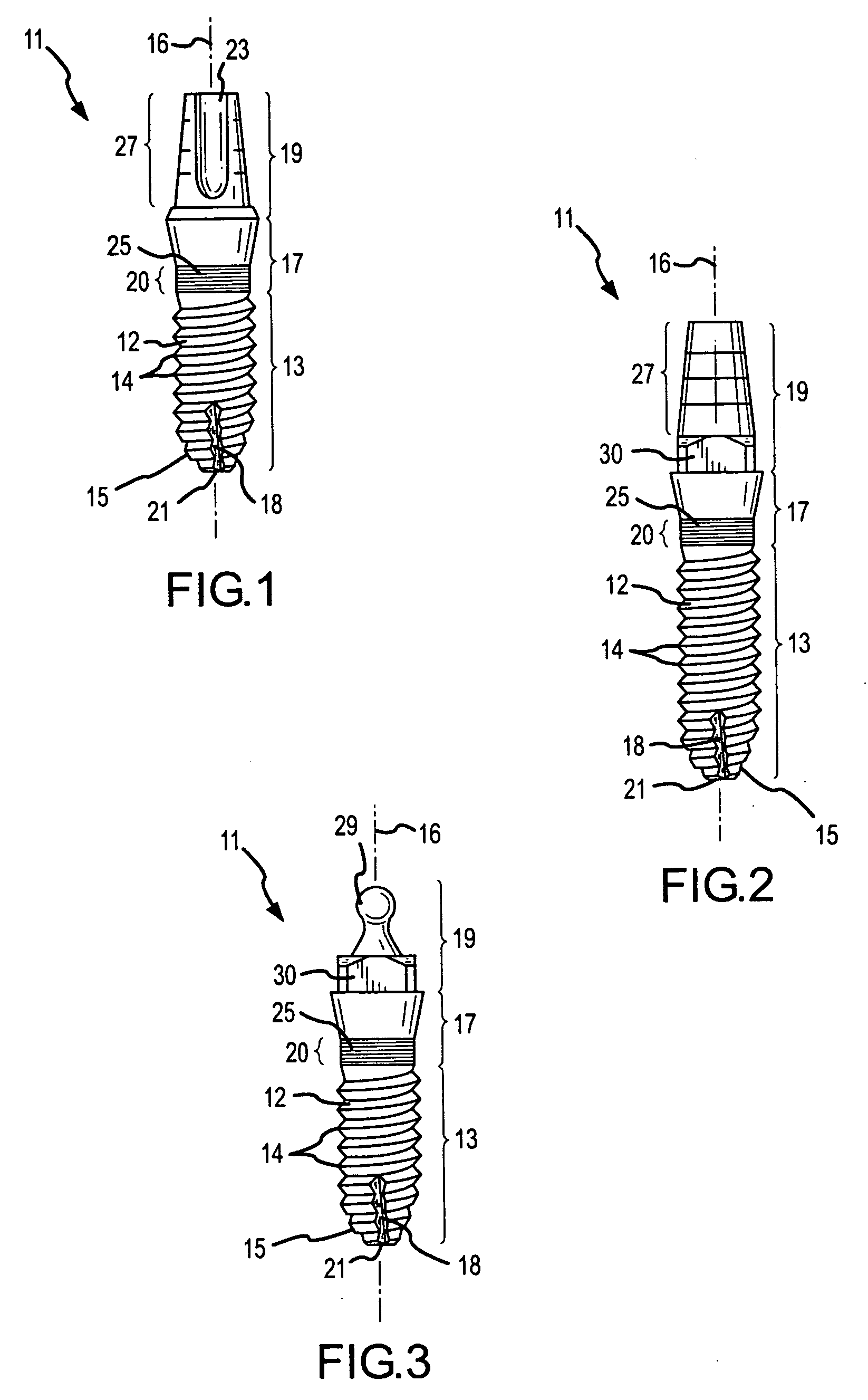 Screw-type dental implant