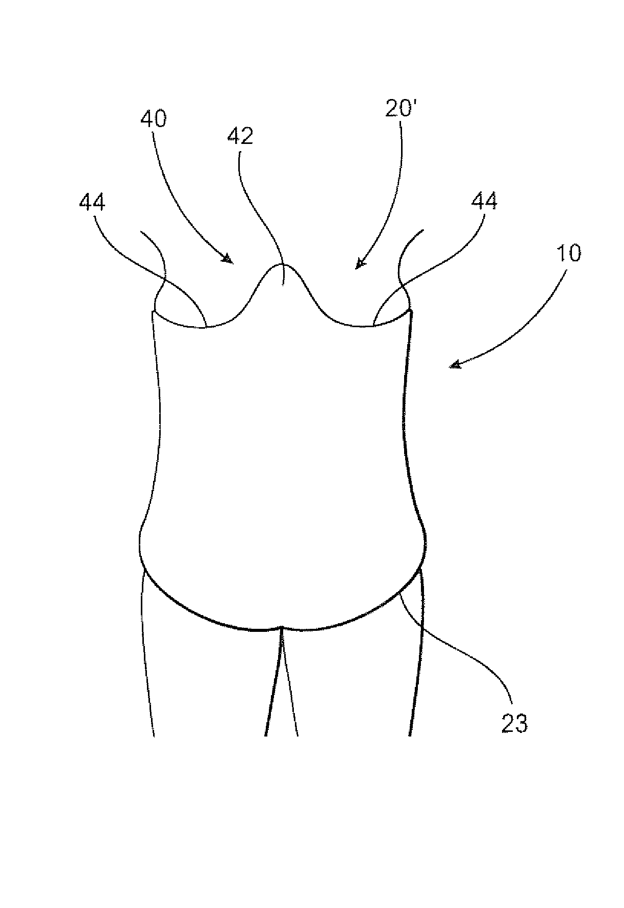 Post operative pressure garment