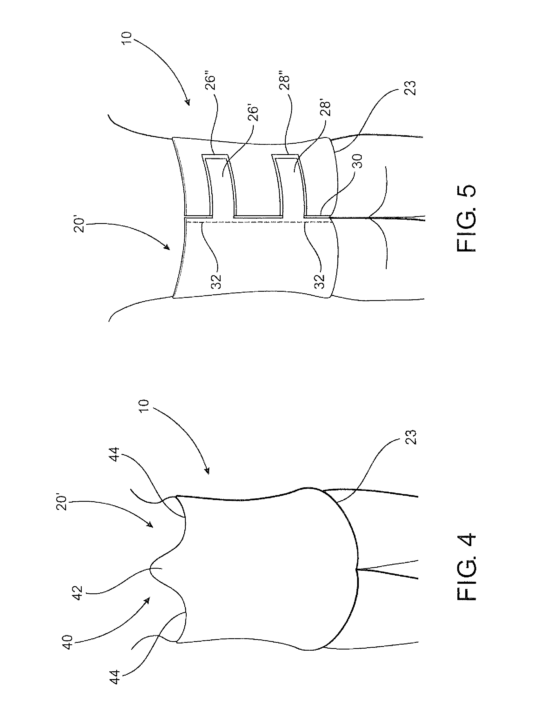 Post operative pressure garment