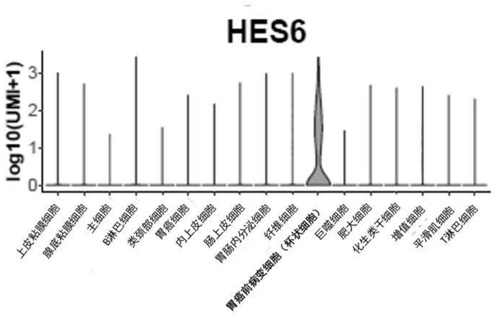 Gastric cancer extremely-early cell marker, gastric cancer precancerous lesion early cell marker and application of markers in diagnostic kits