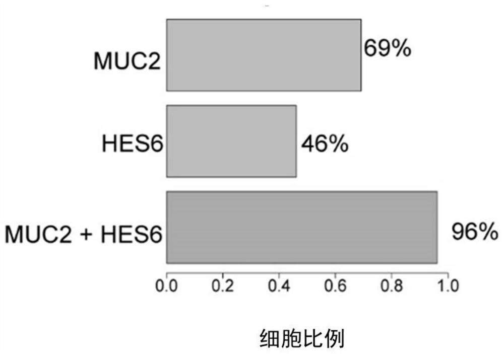 Gastric cancer extremely-early cell marker, gastric cancer precancerous lesion early cell marker and application of markers in diagnostic kits