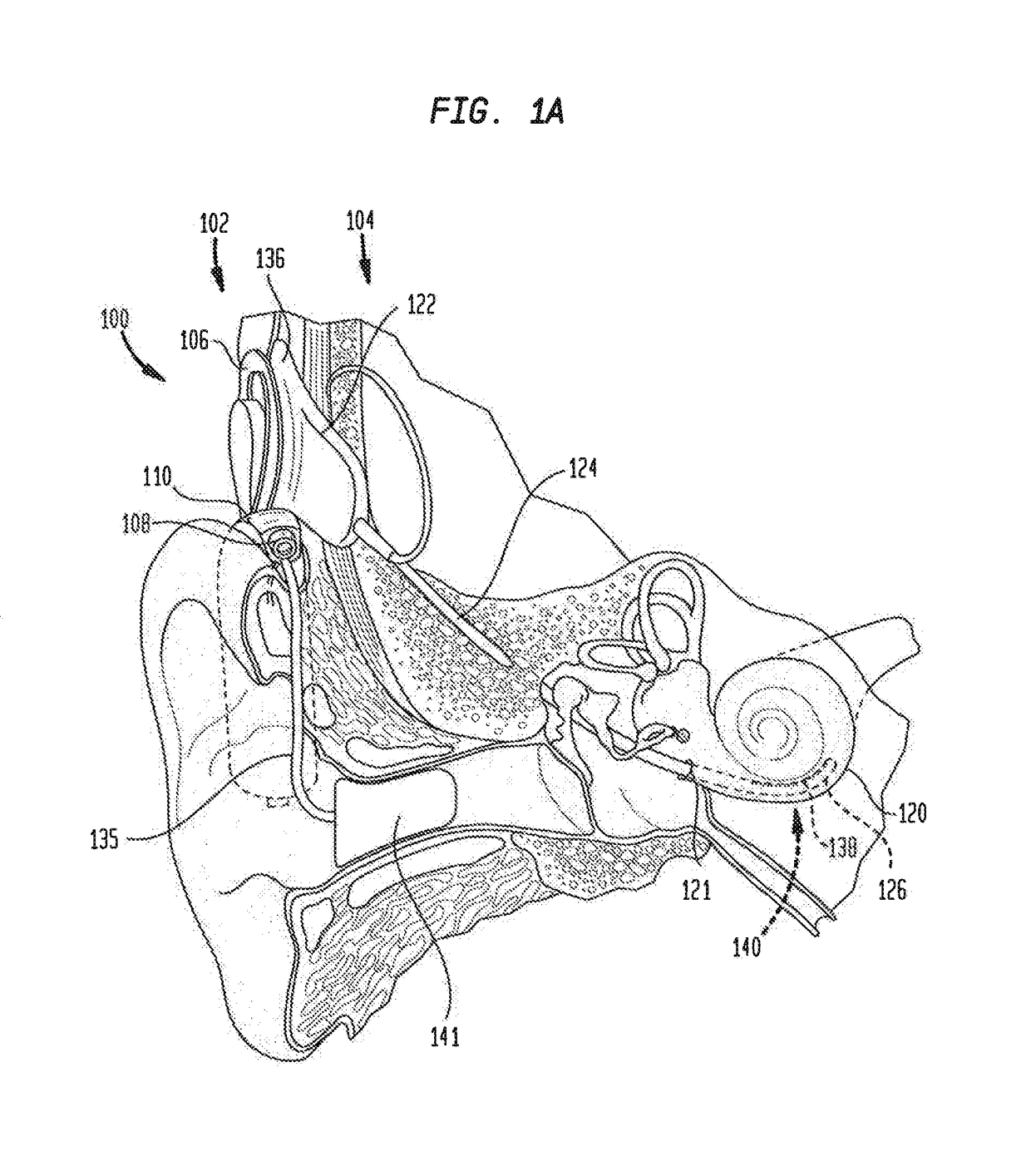 Perception change-based adjustments in hearing prostheses