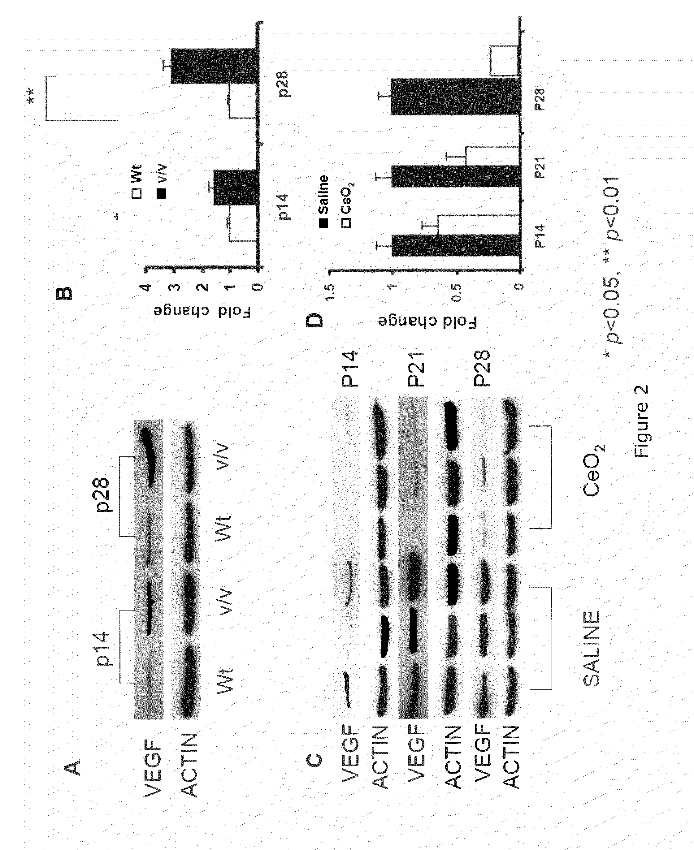 Inhibition of retinal cell degeneration or neovascularization by cerium oxide nanoparticles