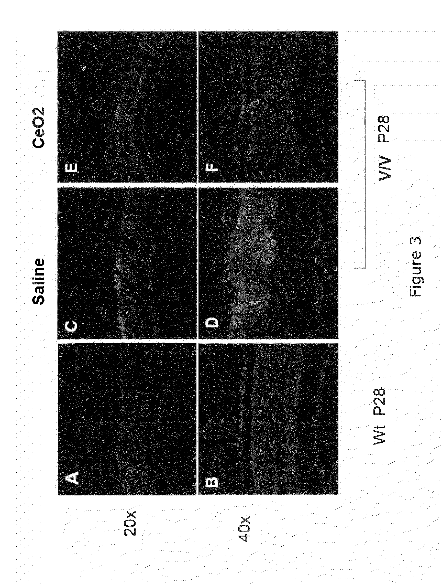 Inhibition of retinal cell degeneration or neovascularization by cerium oxide nanoparticles