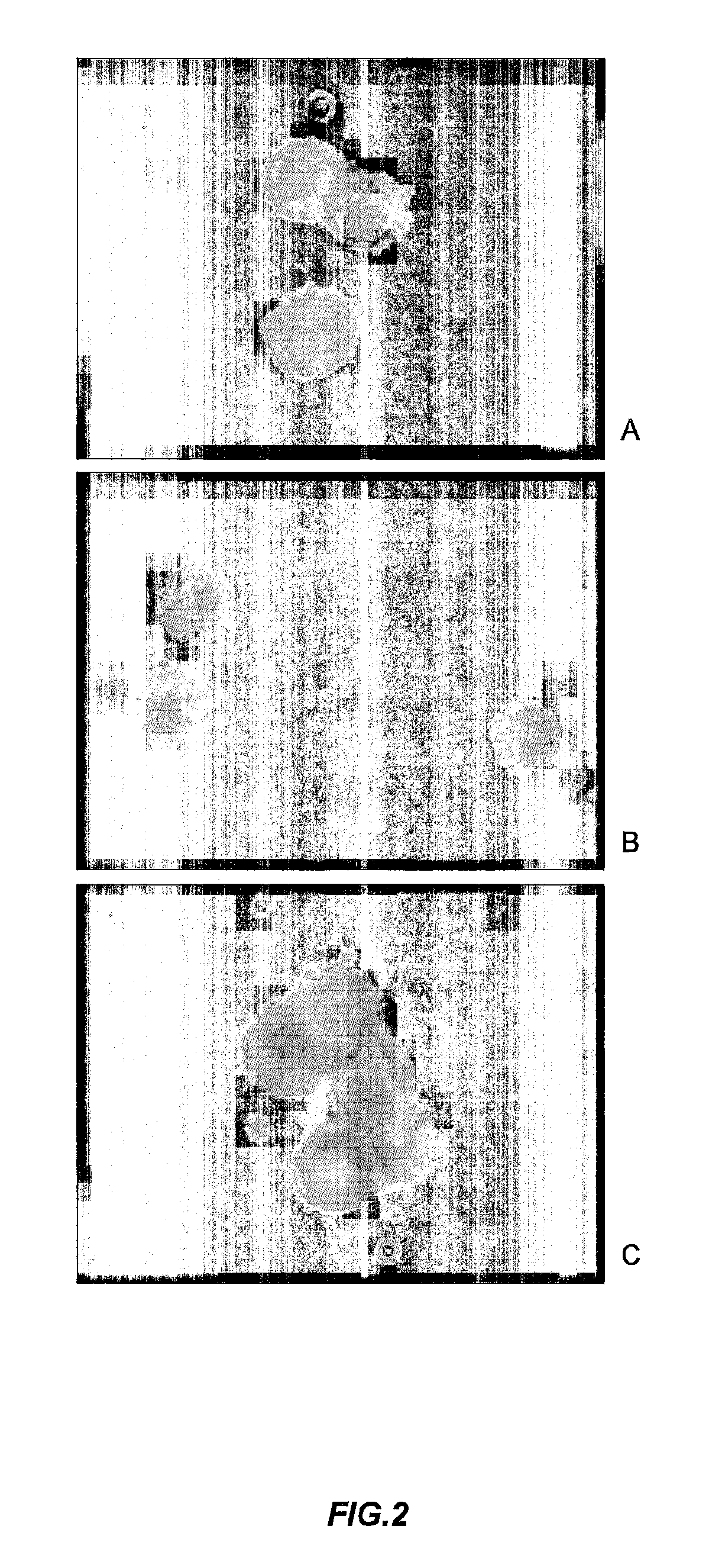 Use of antisecretory factors (AF) for optimizing cellular uptake