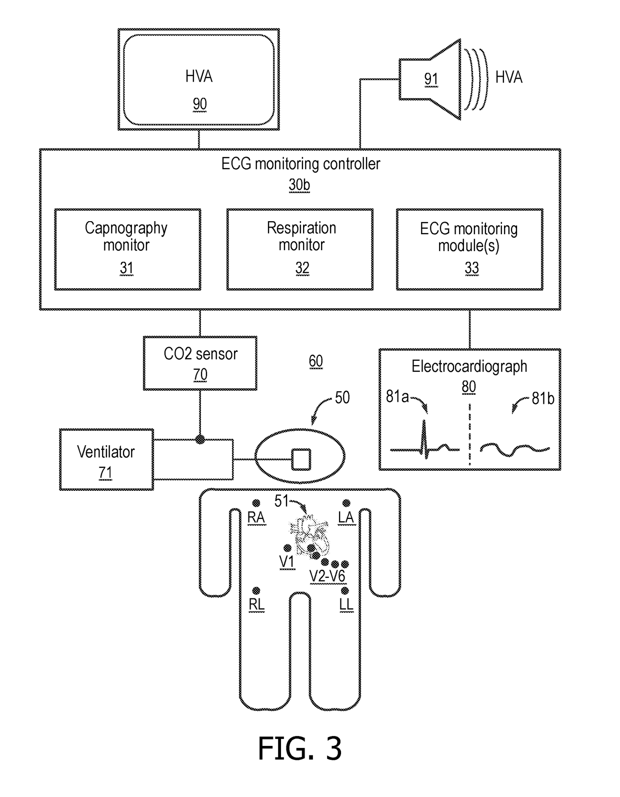 Monitoring device with multi-parameter hyperventilation alert