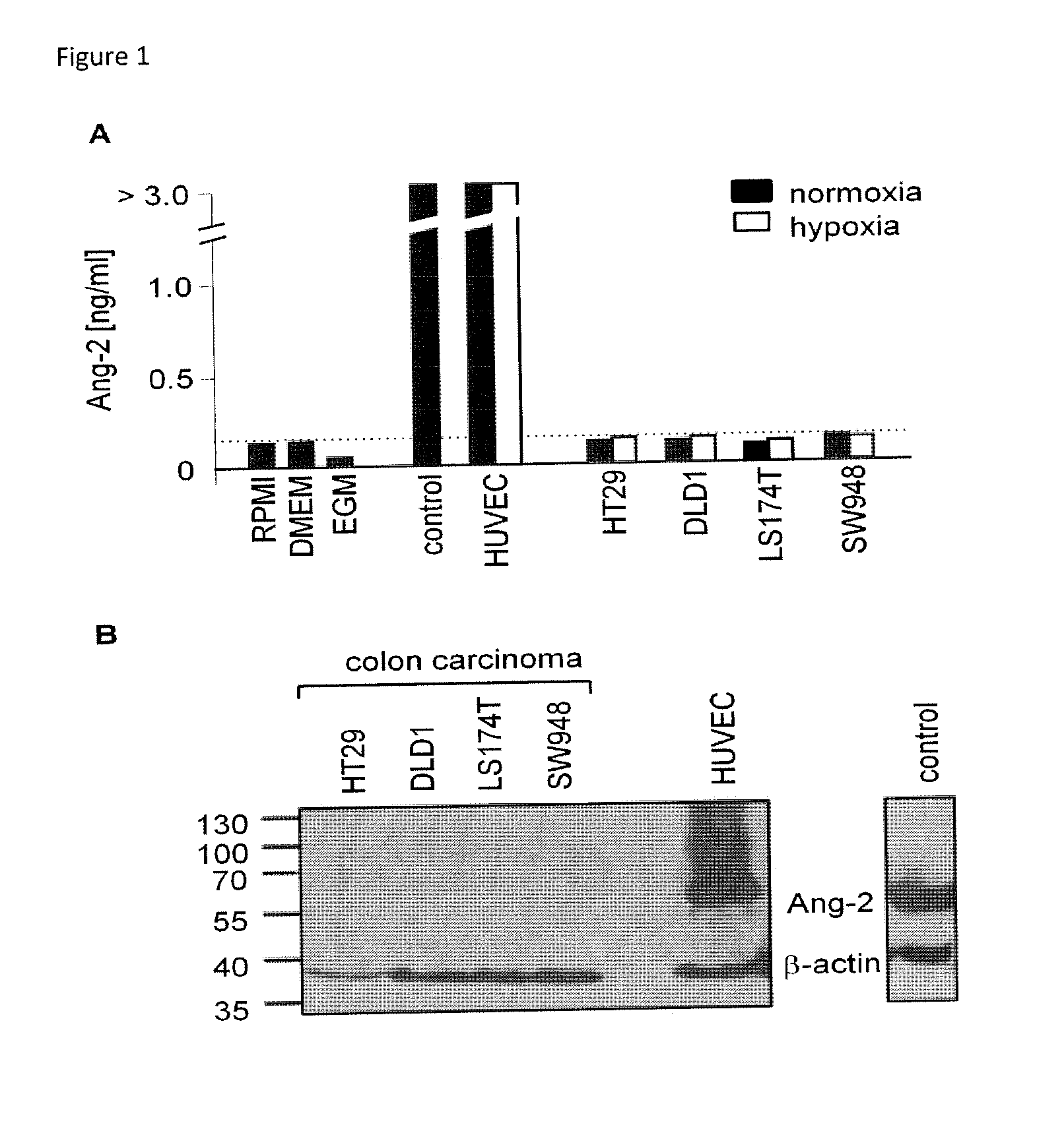 Biomarker for colorectal cancer