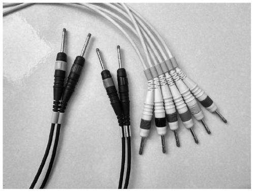 An automated and standardized electrocardiogram acquisition system and method