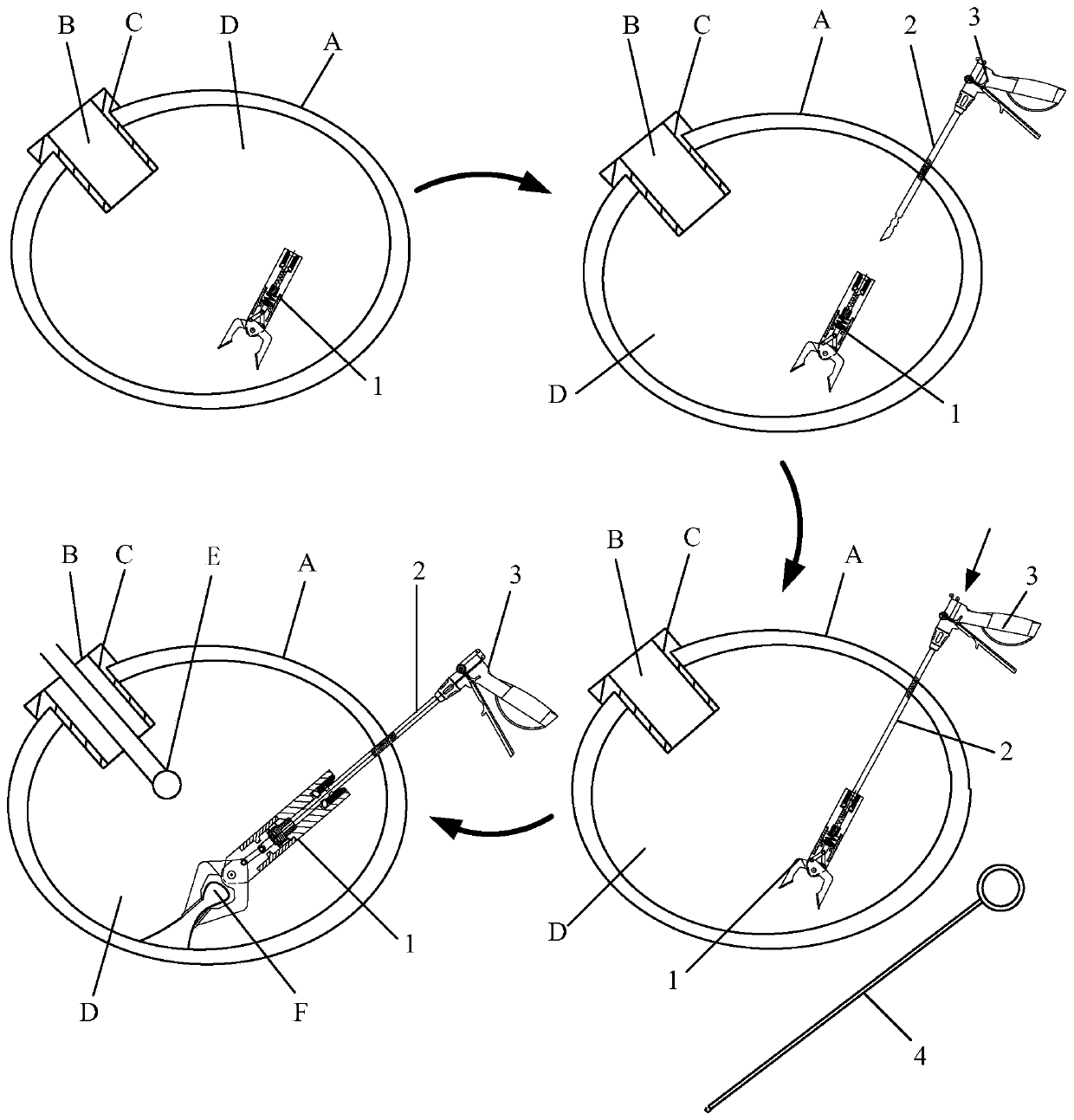 Endoluminal surgical system