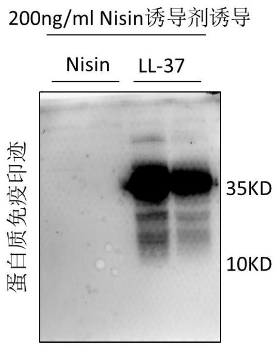 A recombinant expression vector expressing ll-37 polypeptide, recombinant Lactococcus lactis, antiviral drug, construction method and application