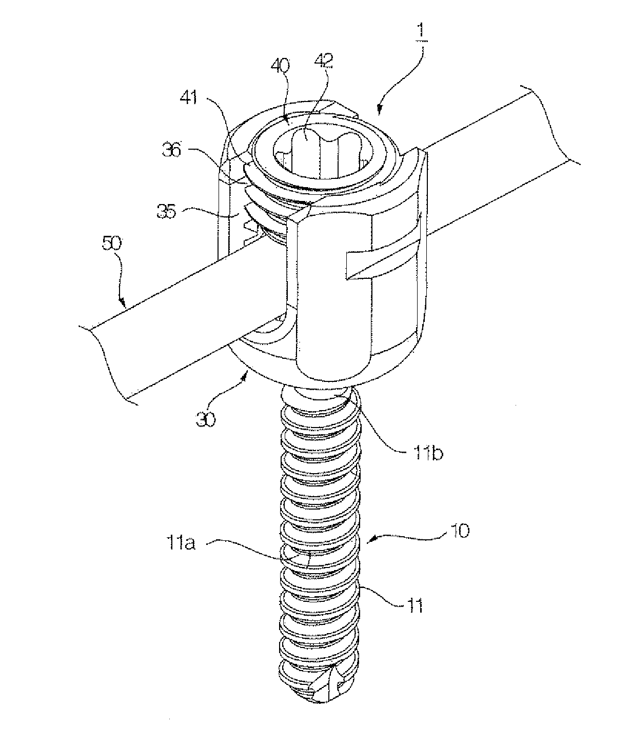 Screw for fixing vertebra