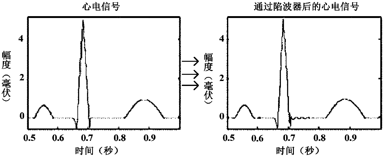 Control method and system for filtering out power frequency interference signals